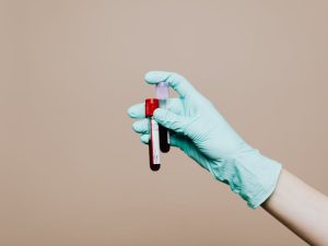 recomanda analize testosteron